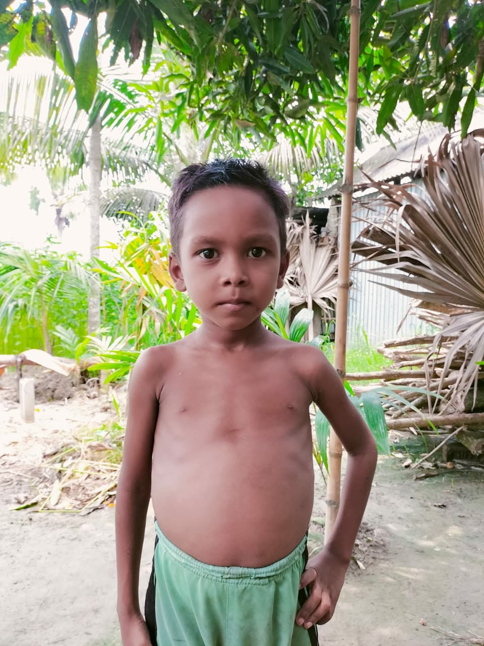 দারিদ্র্যের কাছে হার মানছে চিকিৎসা, বাঁচতে আড়াই লাখ টাকার সহায়তা চায় শিশু মিনহাজ