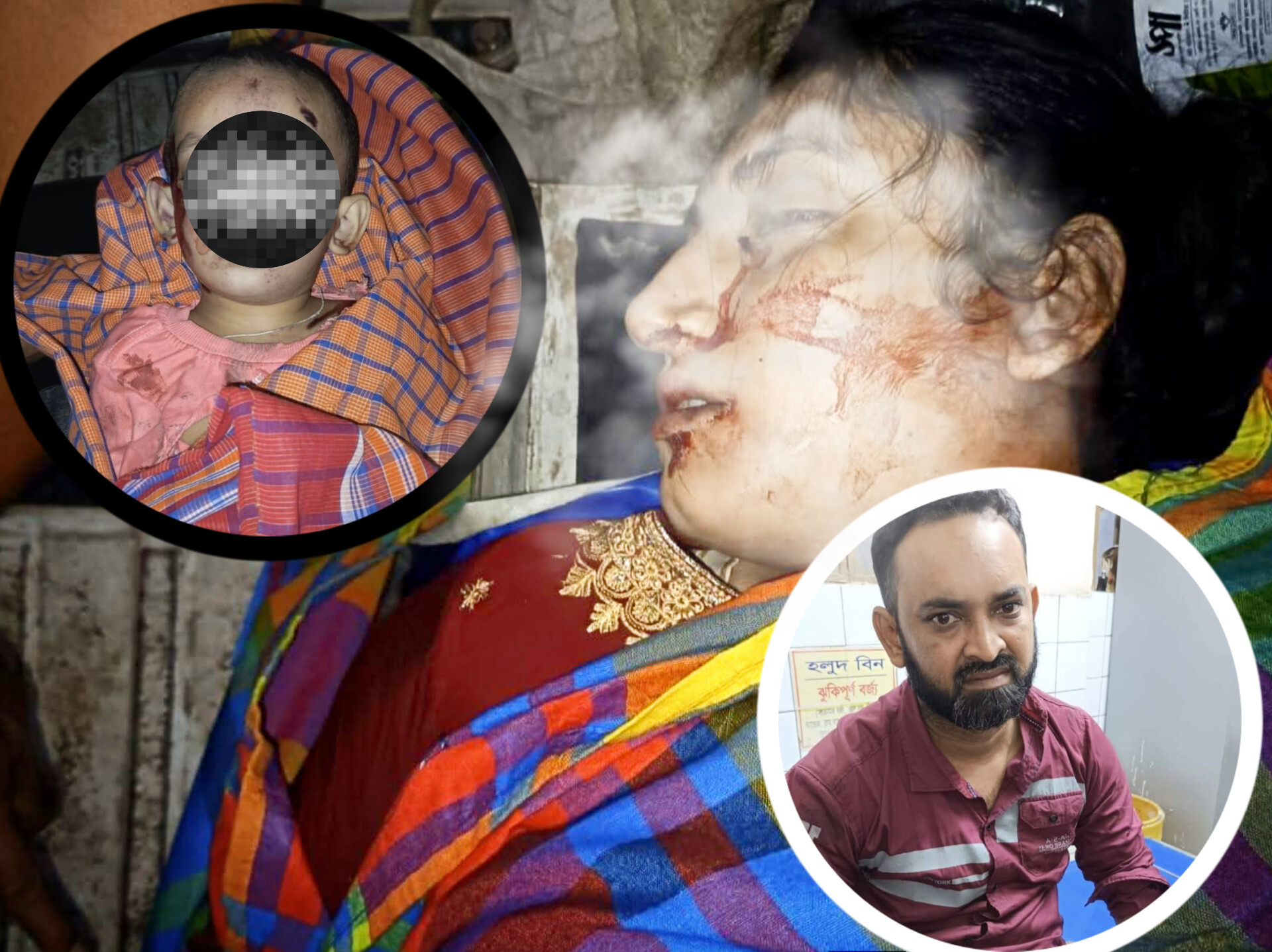 যশোরে পিকআপের ধাক্কায় মা-ছেলে নিহত, আহত বাবা